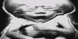 Hory maj� o�i: Trailer